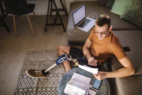 Man with prosthetic leg is set up for work in his living room.